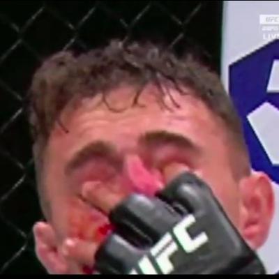 UFC 321 "EYE POKE GATE" Tom Aspinall vs Ciryl Gane is a NO CONTEST!!