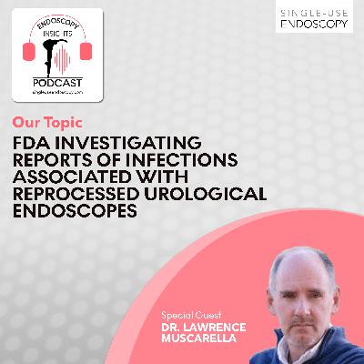 FDA Investigating Reports of Infections Associated with Reprocessed Urological Endoscopes