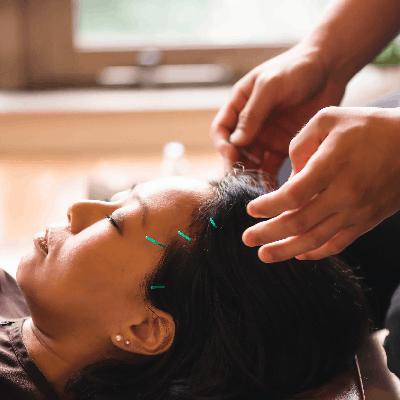 Acupuncture Helps Ease Chemo Brain