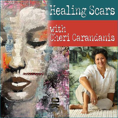 Healing Scars with Cheri Carandanis Healing Scars with Cheri Carandanis