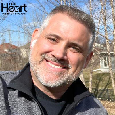 (Q&A) In-Depth Q&A About ICDs: Former Medtronic Employee, Douglas Rachac