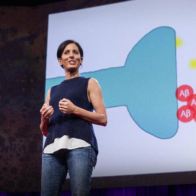 338 预防老年痴呆症的方法 338 预防老年痴呆症的方法