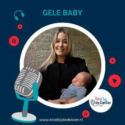 Geel zien bij baby's