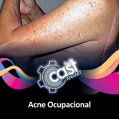 128 - Acne Ocupacional