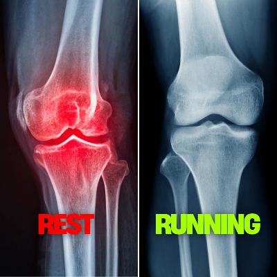 Rest from Running Makes Knee Arthritis Worse Rest from Running Makes Knee Arthritis Worse