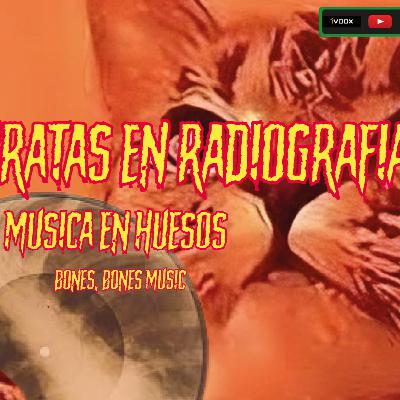 Ep. 26 Los discos piratas soviéticos en radiografía.(MUSICA EN HUESOS).