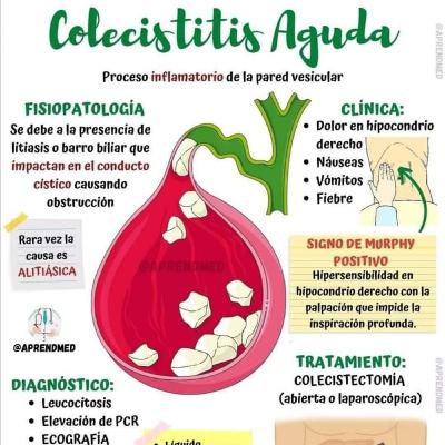 Sesión de colecistitis aguda