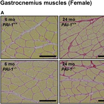 PAI-1 Deficiency Protects Aging Female Mice from Muscle and Bone Loss