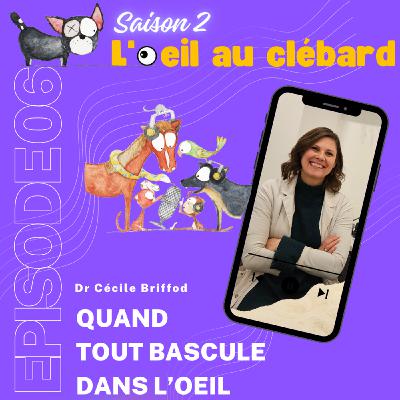 Quand tout bascule dans l'oeil Quand tout bascule dans l'oeil