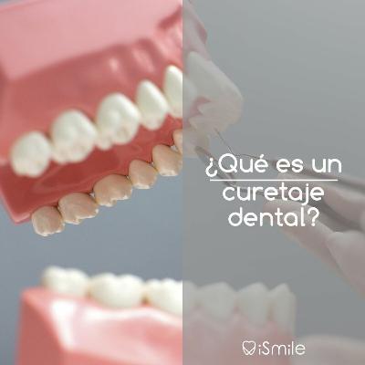 ¿Qué es el curetaje dental?