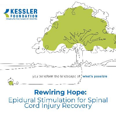 Rewiring Hope: Epidural Stimulation for Spinal Cord Injury Recovery
