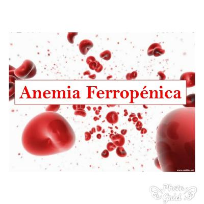 Anemia Ferropénica en mujeres en edad fértil Anemia Ferropénica en mujeres en edad fértil