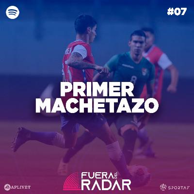 Fuera del Radar #07 | Primer machetazo