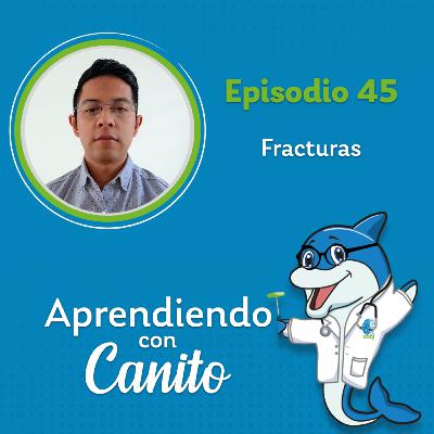 45: Fracturas