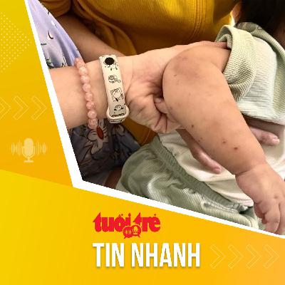 Tin tức sáng 30-10: TP.HCM giám sát 12 trường mầm non, phát hiện 8 trường có ổ dịch tay chân miệng Tin tức sáng 30-10: TP.HCM giám sát 12 trường mầm non, phát hiện 8 trường có ổ dịch tay chân miệng