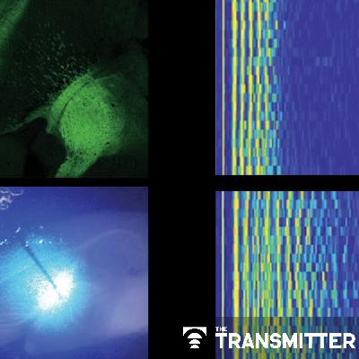 Sensory gatekeeper drives seizures, autism-like behaviors in mouse model