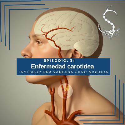 Episodio 31. Enfermedad carotídea