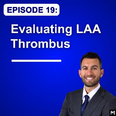 19. How to Evaluate Left Atrial Appendage Thrombus With TEE (Transesophageal Echocardiography)