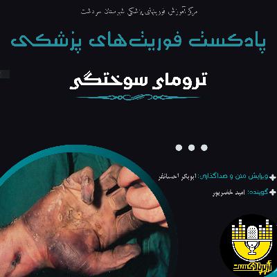 پروتکل آفلاین سوختگی
