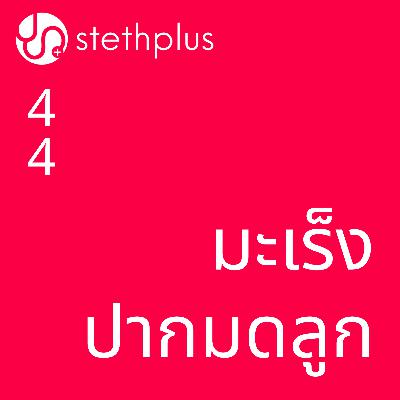 stethplus ep 44 - มะเร็งปากมดลูก
