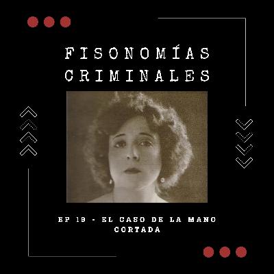 Ep. 19 - El caso de la mano cortada