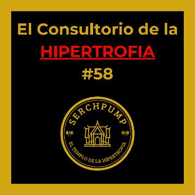 Relación Estímulo / Fatiga - Máquinas vs Pesos Libres | El Consultorio de la Hipertrofia #58