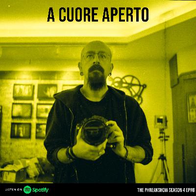 A Cuore Aperto