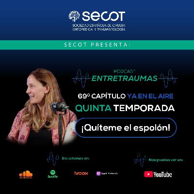 ¡Quíteme el espolón! ¡Quíteme el espolón!