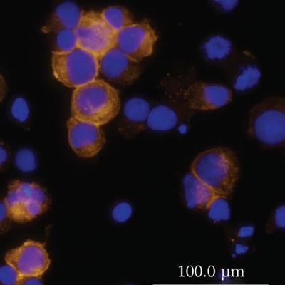 Recognition and Response (Immunology part 3)
