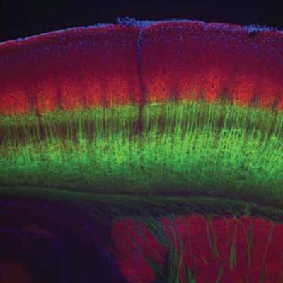 The Chemistry of Perception — Taste, Smell, and the Origins of Sensation (Section 2) The Chemistry of Perception — Taste, Smell, and the Origins of Sensation (Section 2)