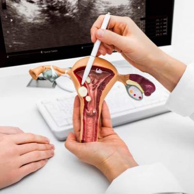 Phương pháp mới bảo tồn tử cung và khả năng sinh sản cho phụ nữ bị u xơ