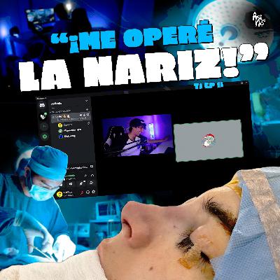 AsíNoEs | Me operé... LA NARIZ 🩺 *La Historia de PACOLO*🦜(T.1 Ep.11)