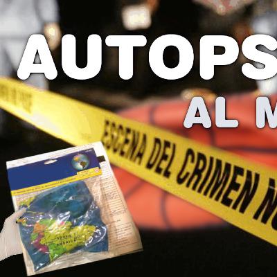 AUTOPSIA AL MODELO AUTOPSIA AL MODELO