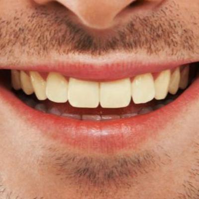 Bright White Teeth - Season 2 Nugget 3