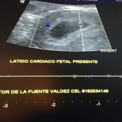 Voy a ser papá