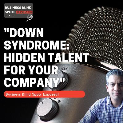 "Down Syndrome: Hidden Talent For Your Company"