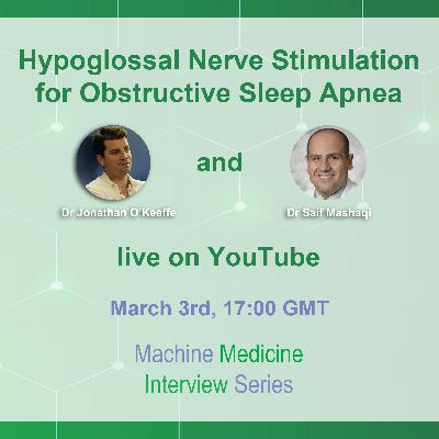 Hypoglossal Nerve Stimulation for Obstructive Sleep Apnea