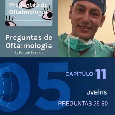 T01 E22 Uveítis (Preguntas 26-50)