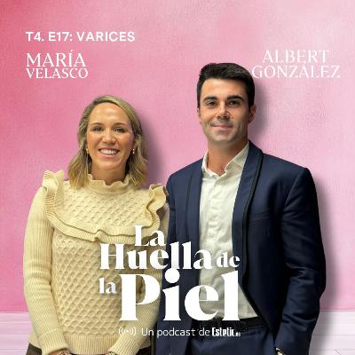 T4. E17. Albert González: Varices T4. E17. Albert González: Varices