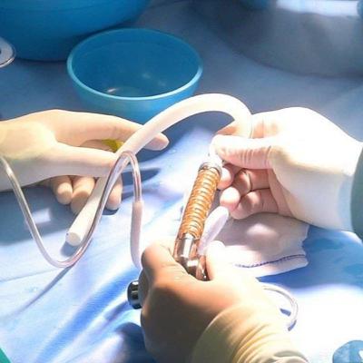 Ca ghép tim người đầu tiên trên thế giới