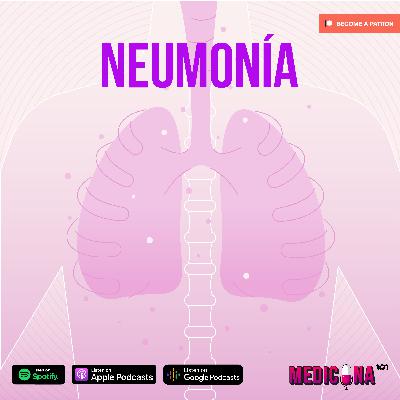 10. Neumonía
