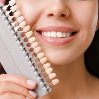 Cost of Porcelain Veneers – What to Expect Before You Commit