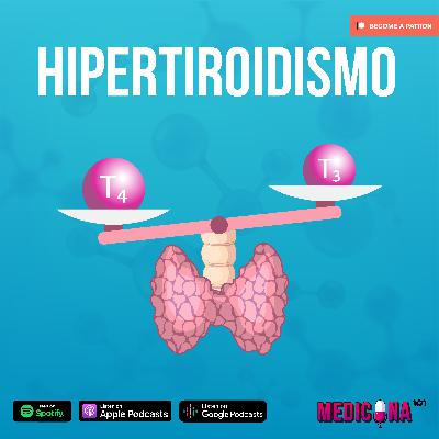 8. Hipertiroidismo