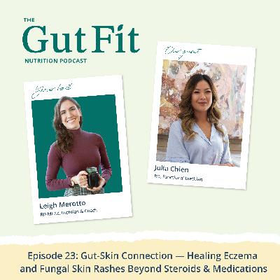 23: Gut-Skin Connection — Healing Eczema and Fungal Skin Rashes Beyond Steroids & Medications 23: Gut-Skin Connection — Healing Eczema and Fungal Skin Rashes Beyond Steroids & Medications
