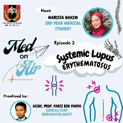 Ep 3: Systemic Lupus Erythematosus (SLE)