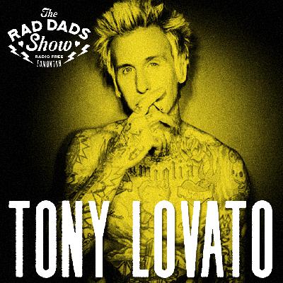 TONY LOVATO (MEST)