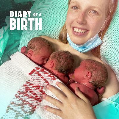 The Mum Whose Spontaneous Triplets Arrived All at Once The Mum Whose Spontaneous Triplets Arrived All at Once