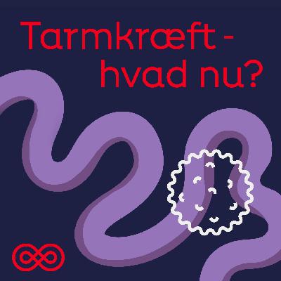 Episode 2: Livet med tarmkræft