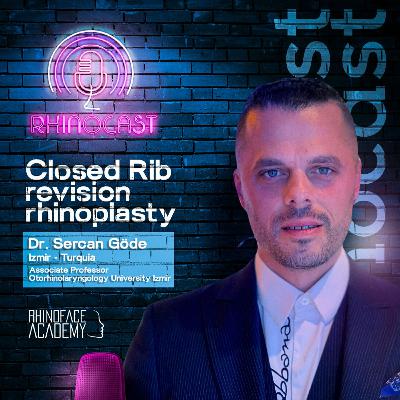 Closed Rib Revision Rhinoplasty | Dr. Sercan Göde 🇹🇷 Closed Rib Revision Rhinoplasty | Dr. Sercan Göde 🇹🇷