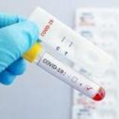 Peranan Bioteknologi dalam Mengatasi Virus Corona